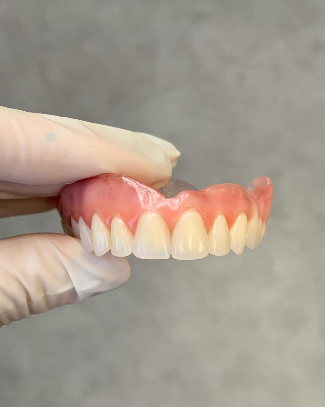 Prótese total superior