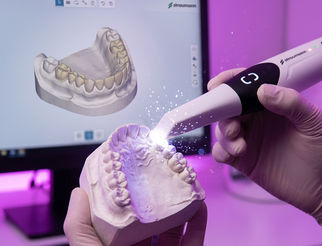 Scanners de bancada e intraorais