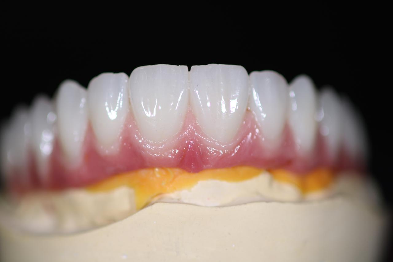 Protocolos & Implantes